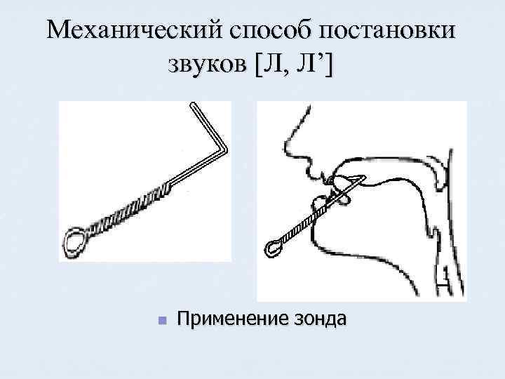 Способ постановки. Механическая постановка звука л. Постановка звука с механическим способом. Постановка звука л зондом. Постановка звука р механическим способом.