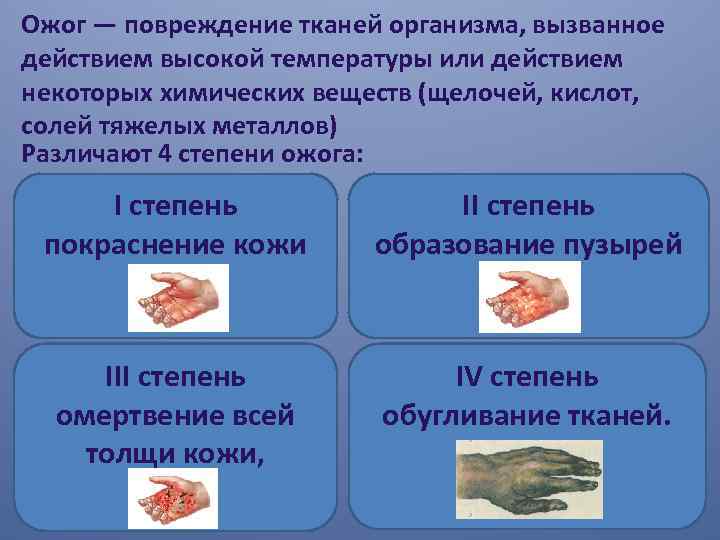 Ожог — повреждение тканей организма, вызванное действием высокой температуры или действием некоторых химических веществ