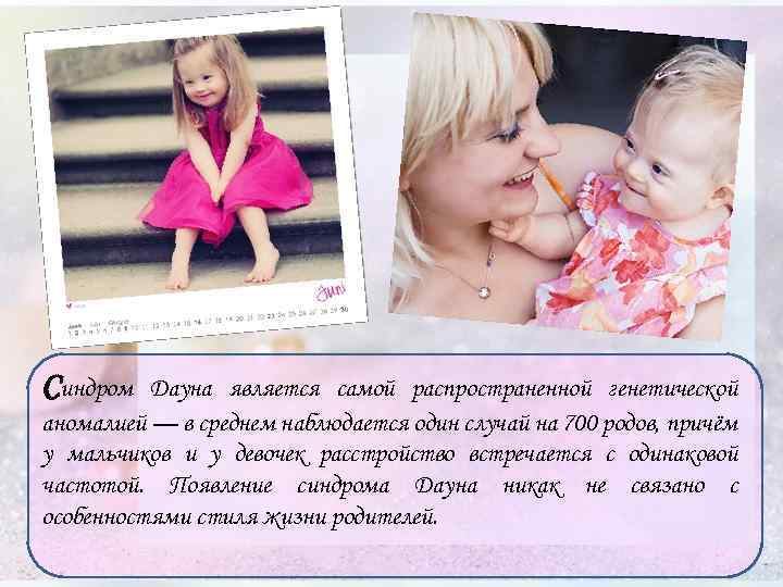 Синдром Дауна является самой распространенной генетической аномалией — в среднем наблюдается один случай на