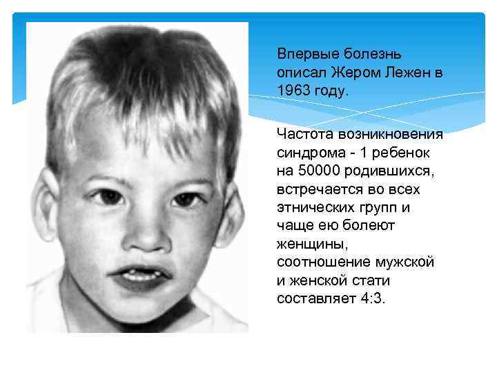 Впервые болезнь описал Жером Лежен в 1963 году. Частота возникновения синдрома - 1 ребенок
