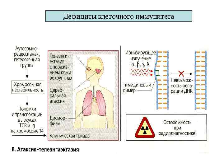 Дефициты клеточного иммунитета 