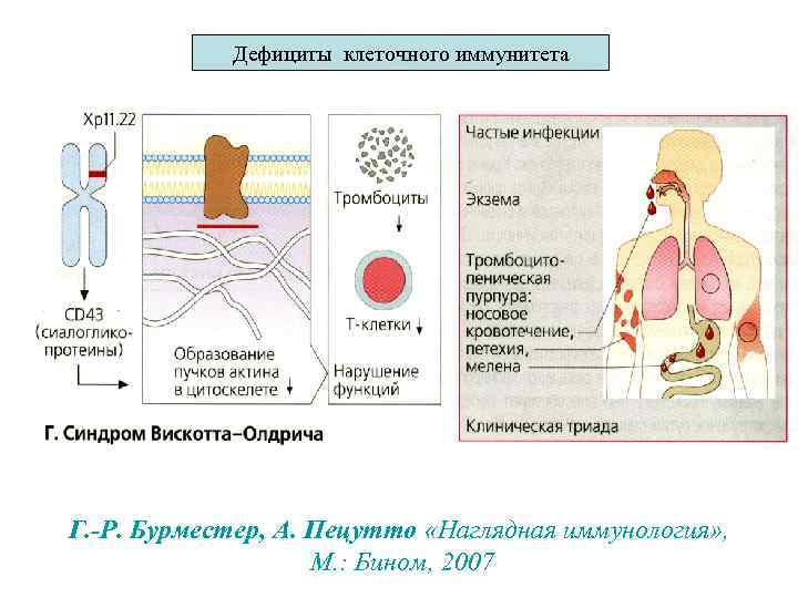 Дефициты клеточного иммунитета Г. -Р. Бурместер, А. Пецутто «Наглядная иммунология» , М. : Бином,