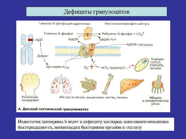 Дефициты гранулоцитов Недостаток цитохрома b ведет к дефициту кислород-зависимого механизма бактерицидности, колонизации бактериями органов