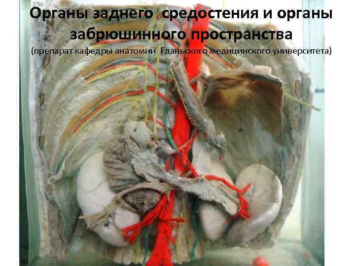 Органы заднего средостения и органы забрюшинного пространства (препарат кафедры анатомии Гданьского медицинского университета) 