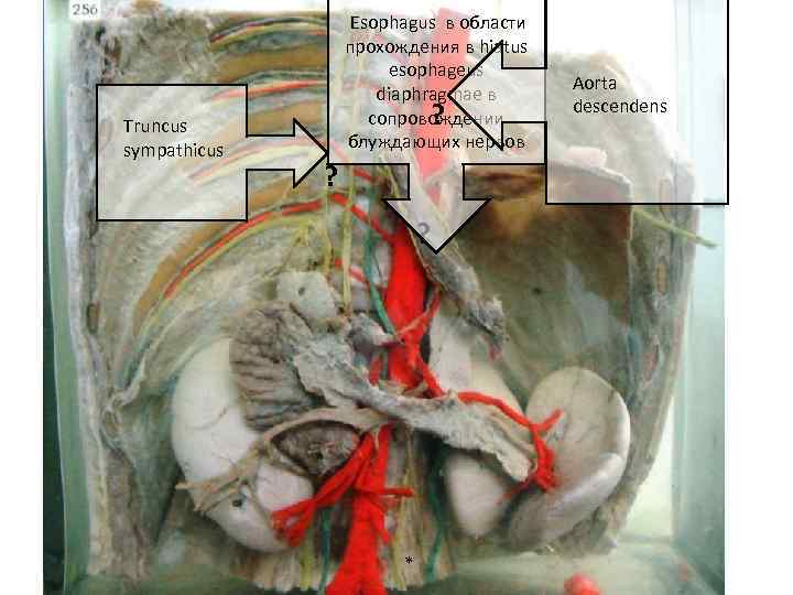 Truncus sympathicus Esophagus в области прохождения в hiatus esophageus diaphragmae в сопровождении ? блуждающих