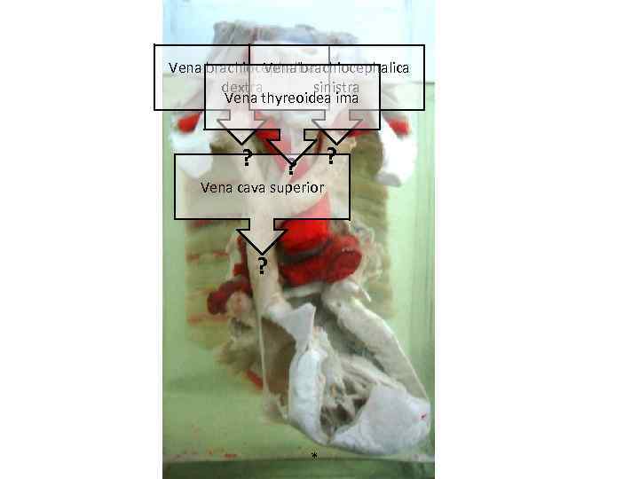 Vena brachiocephalica dextra sinistra Vena thyreoidea ima ? ? ? Vena cava superior ?