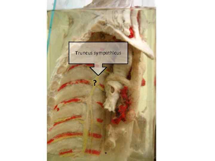 Truncus sympathicus ? * 