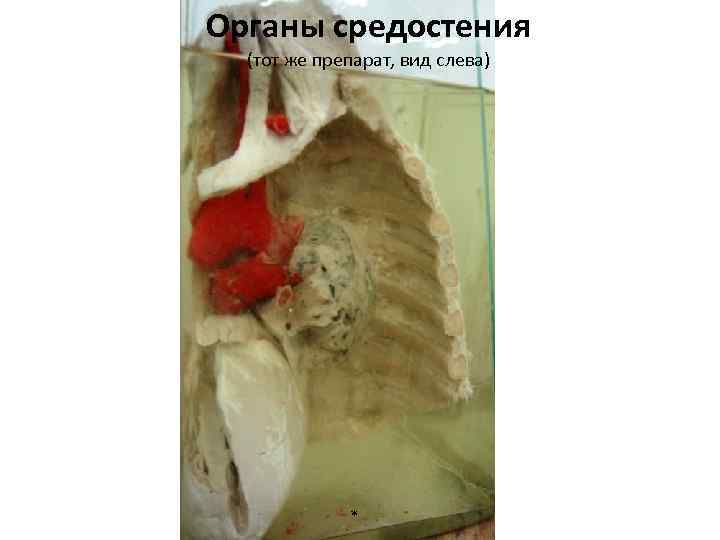 Органы средостения (тот же препарат, вид слева) * 