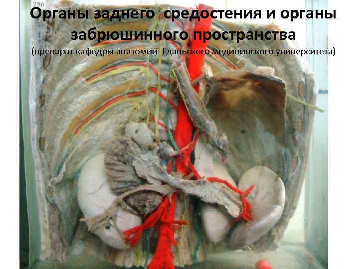 Органы заднего средостения и органы забрюшинного пространства (препарат кафедры анатомии Гданьского медицинского университета) 