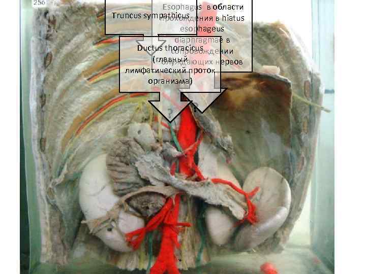 Esophagus в области Truncus sympathicus прохождения в hiatus esophageus diaphragmae в Ductus thoracicus ?