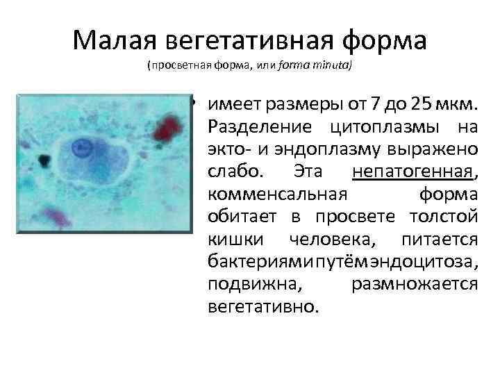 Малая вегетативная форма (просветная форма, или forma minuta) • имеет размеры от 7 до