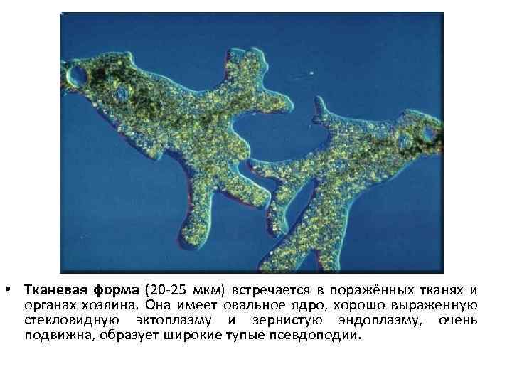  • Тканевая форма (20 25 мкм) встречается в поражённых тканях и органах хозяина.