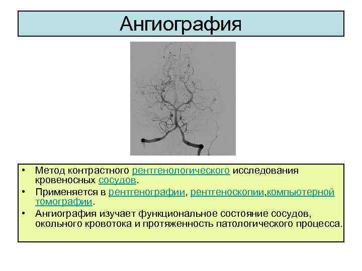 Ангиография • Метод контрастного рентгенологического исследования кровеносных сосудов. • Применяется в рентгенографии, рентгеноскопии, компьютерной