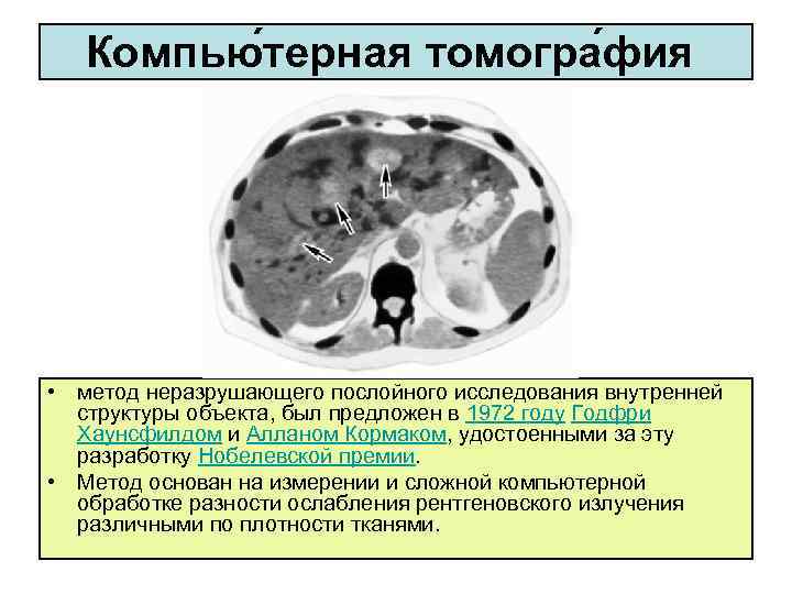 Компью терная томогра фия • метод неразрушающего послойного исследования внутренней структуры объекта, был предложен