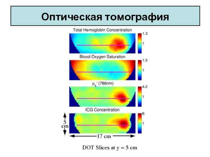 Оптическая томография 