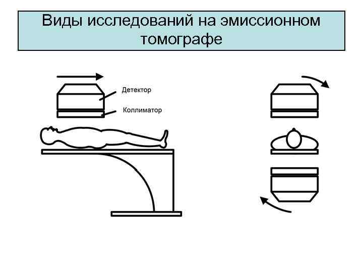 Виды исследований на эмиссионном томографе 
