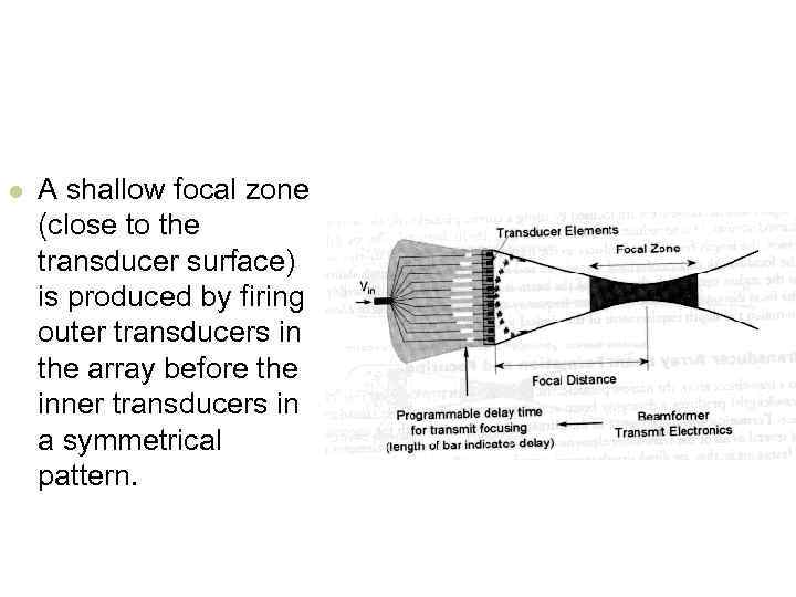 l A shallow focal zone (close to the transducer surface) is produced by firing