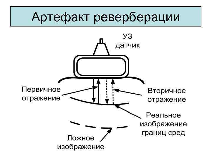 Артефакты в проекте это