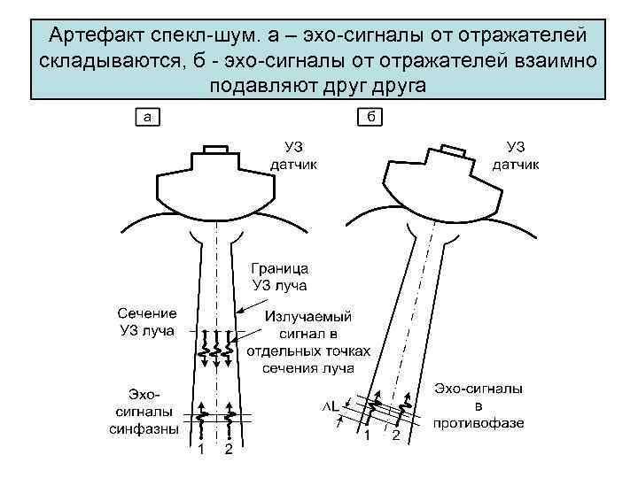 Спекл шум на изображении