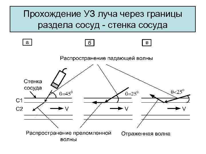 Прохождение УЗ луча через границы раздела сосуд стенка сосуда 
