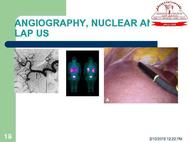 ANGIOGRAPHY, NUCLEAR AND LAP US 18 2/10/2018 12: 22 PM 