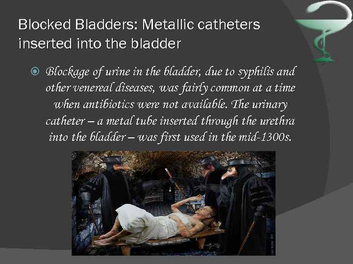 Blocked Bladders: Metallic catheters inserted into the bladder Blockage of urine in the bladder,