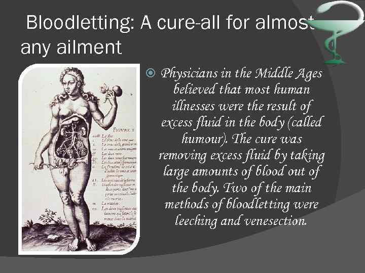 Bloodletting: A cure-all for almost any ailment Physicians in the Middle Ages believed that