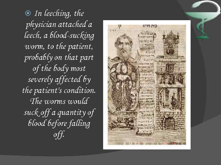 In leeching, the physician attached a leech, a blood-sucking worm, to the patient, probably