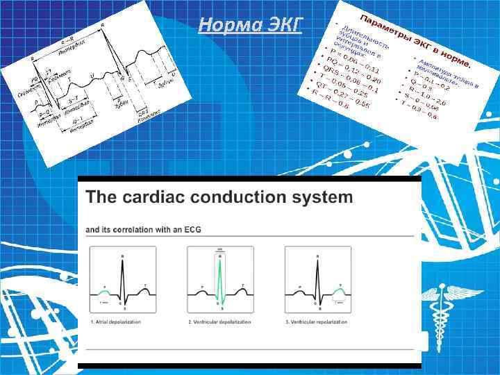 Норма ЭКГ 