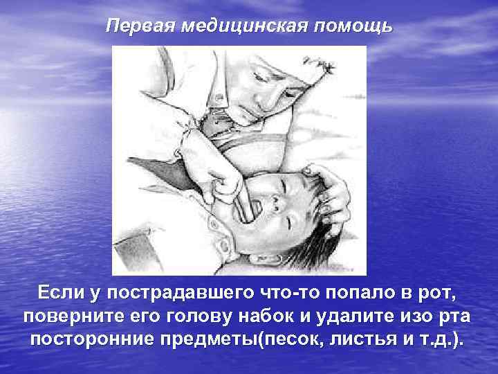 Первая медицинская помощь Если у пострадавшего что-то попало в рот, поверните его голову набок