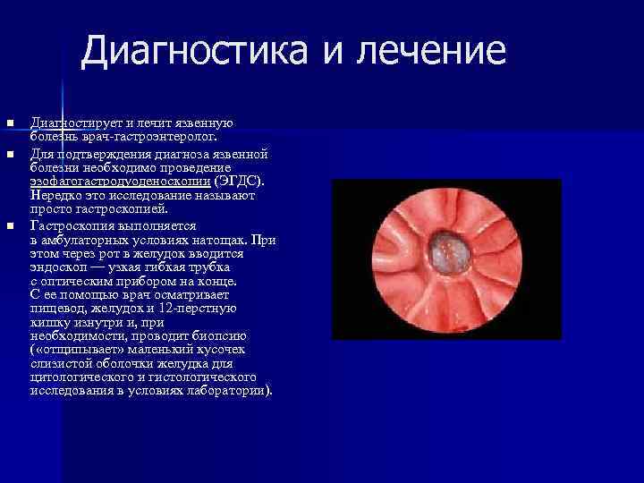 Диагностика и лечение n n n Диагностирует и лечит язвенную болезнь врач-гастроэнтеролог. Для подтверждения