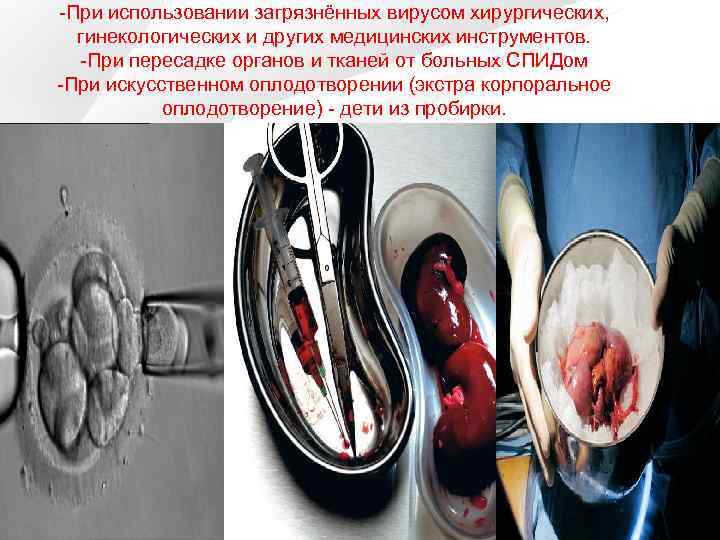 -При использовании загрязнённых вирусом хирургических, гинекологических и других медицинских инструментов. -При пересадке органов и