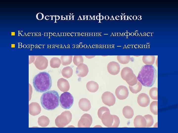 Патология белой крови патофизиология презентация. Презентация патология белой крови. Острый лимфолейкоз картина крови.