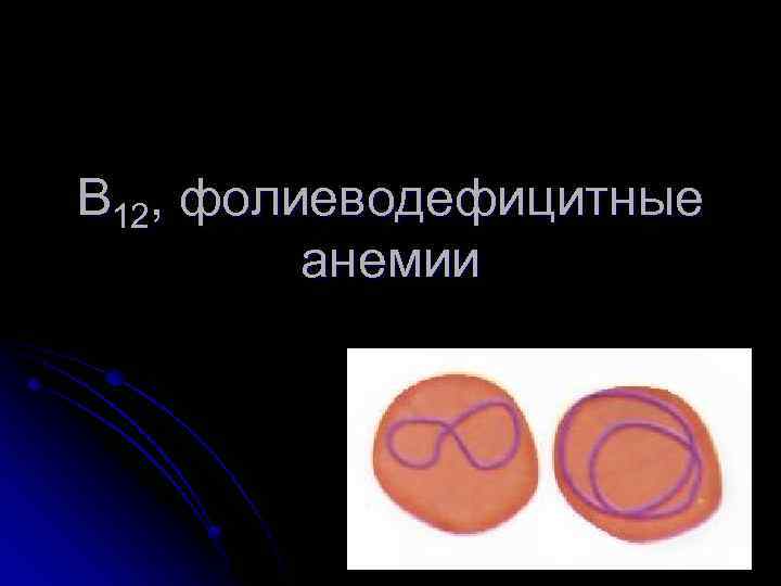 В 12, фолиеводефицитные анемии 