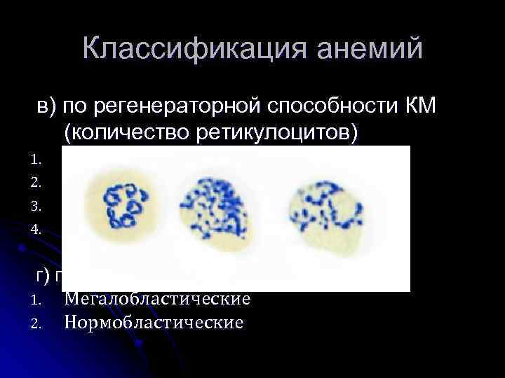 Классификация анемий в) по регенераторной способности КМ (количество ретикулоцитов) 1. 2. 3. 4. Регенераторные