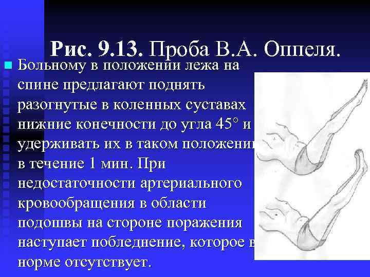 232 n Рис. 9. 13. Проба В. А. Оппеля. Больному в положении лежа на