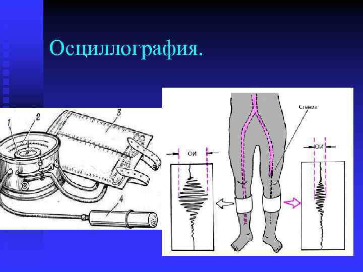 Осциллография. 