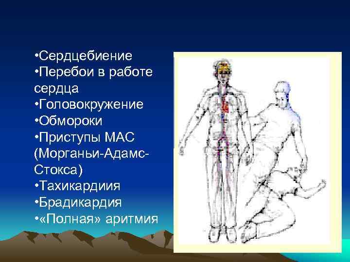  • Сердцебиение • Перебои в работе сердца • Головокружение • Обмороки • Приступы