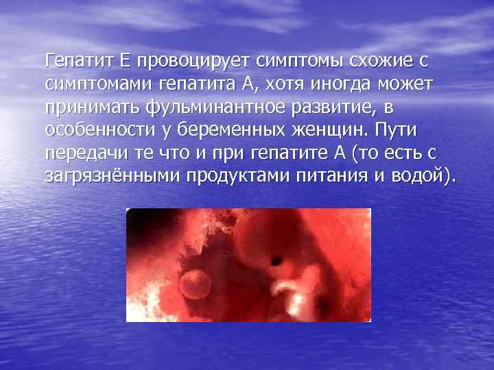 Гепатит Е провоцирует симптомы схожие с симптомами гепатита А, хотя иногда может принимать фульминантное