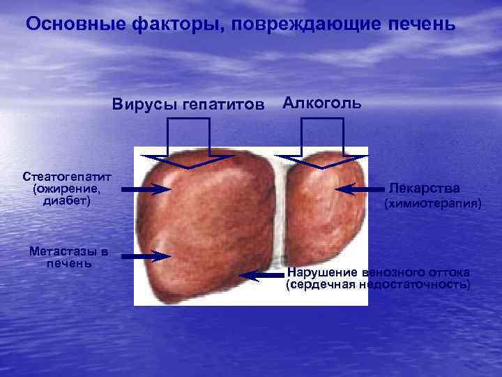 Основные факторы, повреждающие печень Вирусы гепатитов Стеатогепатит (ожирение, диабет) Метастазы в печень Алкоголь Лекарства