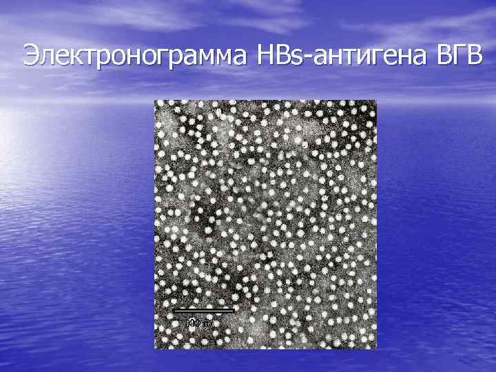 Электронограмма HBs-антигена ВГВ 