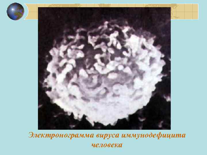 Электронограмма вируса иммунодефицита человека 