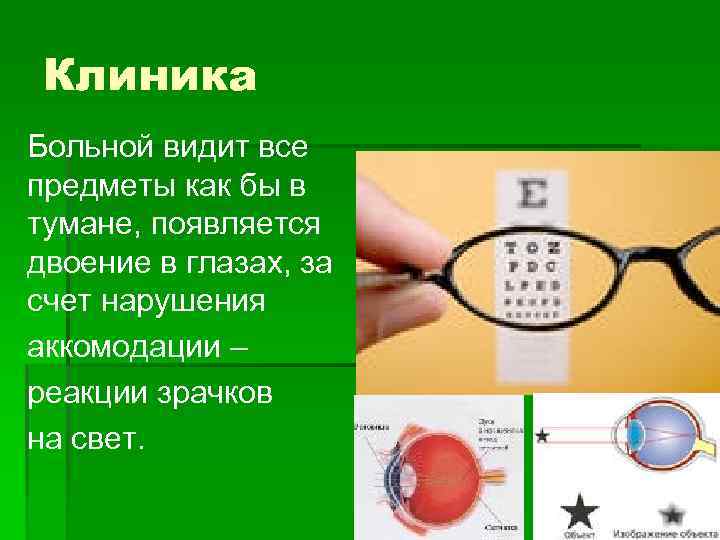 Клиника Больной видит все предметы как бы в тумане, появляется двоение в глазах, за