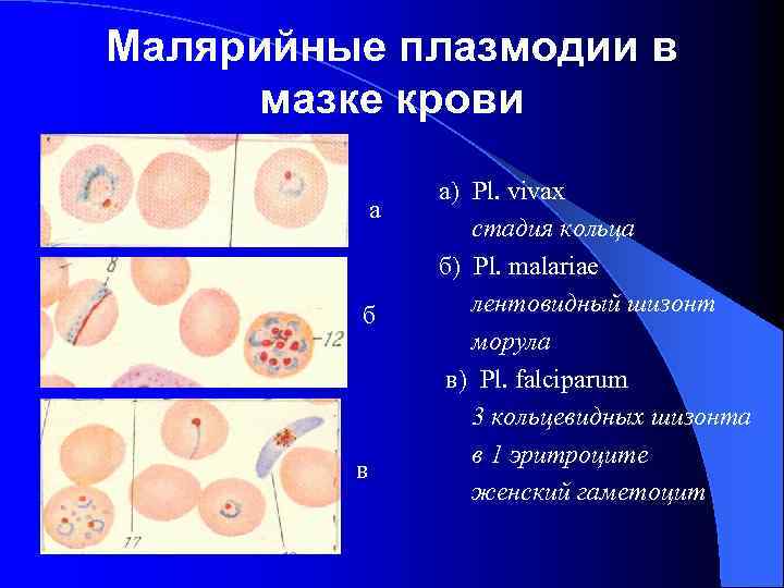 Фото мазков на малярию