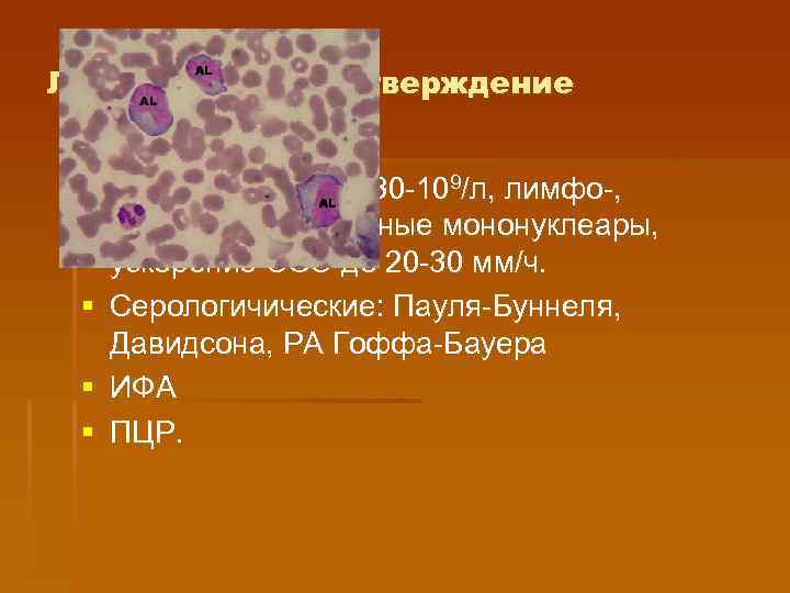 Лабораторное подтверждение § Лейкоцитоз до 15 -30 -109/л, лимфо-, моноцитоз, атипичные мононуклеары, ускорение СОЭ