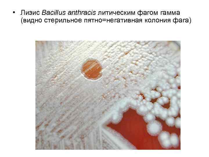  • Лизис Bacillus anthracis литическим фагом гамма (видно стерильное пятно=негативная колония фага) 