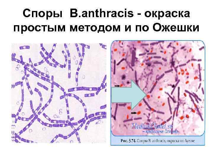 Споры B. anthracis - окраска простым методом и по Ожешки 