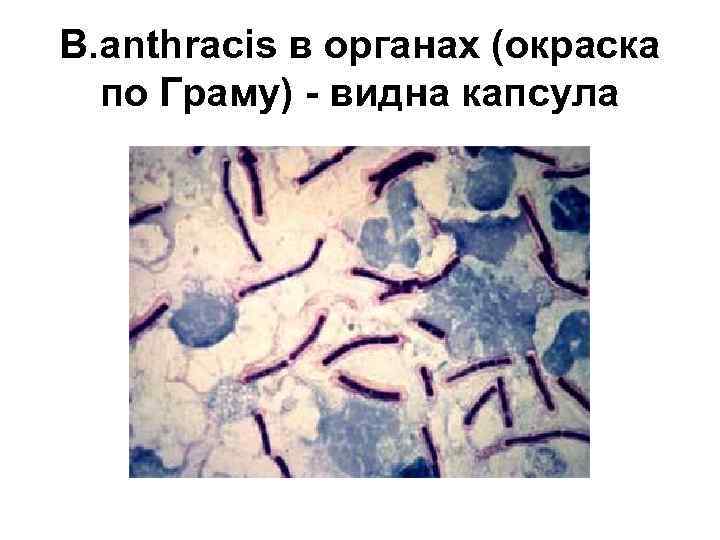 B. аnthracis в органах (окраска по Граму) - видна капсула 