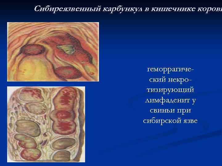 Сибиреязвенный карбункул в кишечнике коровы геморрагический некротизирующий лимфаденит у свиньи при сибирской язве 