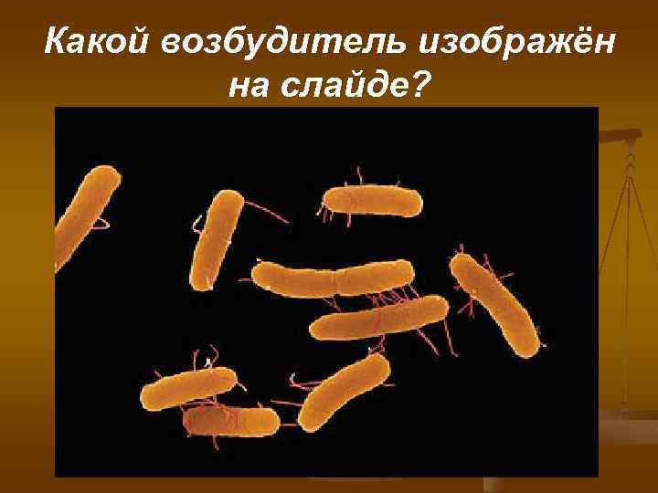 Какой возбудитель изображён на слайде? 